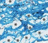 Microscopic view of a section of bile duct from Dr. Neil D. Theise’s 2018 interstitium article, where the asterisks (*) indicate the fluid-filled tubes of the interstitium dispersed among the bands of collagen bundles (Benias et al. 2018). No changes have been made to the image. Permission was granted under Creative Commons Attribution 4.0 International License. To view the license, visit https://creativecommons.org/licenses/by/4.0/.